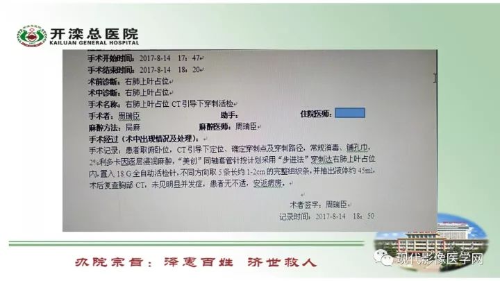 【病例】肺部结节病6例读片
