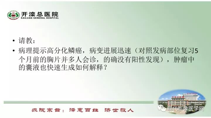【病例】肺部结节病6例读片