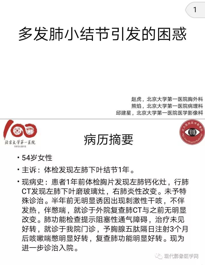 【病例】肺部结节病6例读片