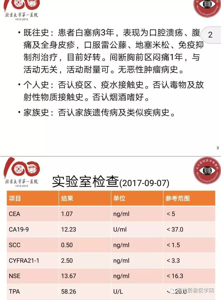 【病例】肺部结节病6例读片
