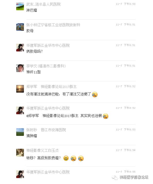【病例】罕见高灌注的中枢神经系统淋巴瘤1例MR