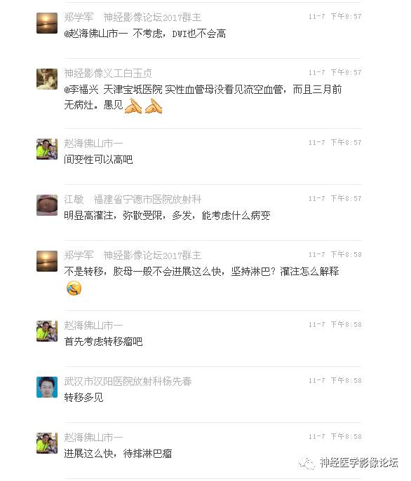 【病例】罕见高灌注的中枢神经系统淋巴瘤1例MR