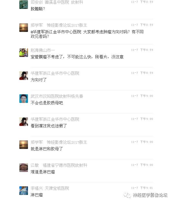 【病例】罕见高灌注的中枢神经系统淋巴瘤1例MR
