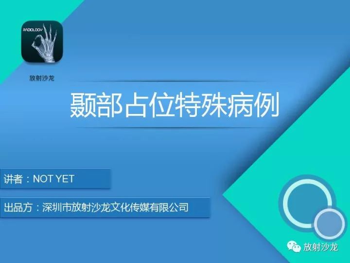 【病例】颞部腺泡状横纹肌肉瘤1例MR影像表现