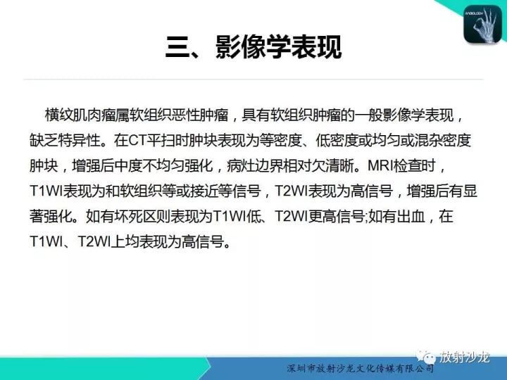 【病例】颞部腺泡状横纹肌肉瘤1例MR影像表现