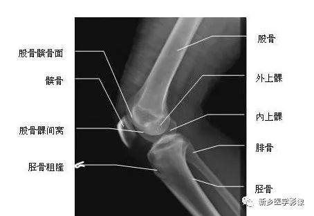 详细的膝关节X线解剖+解读+测量