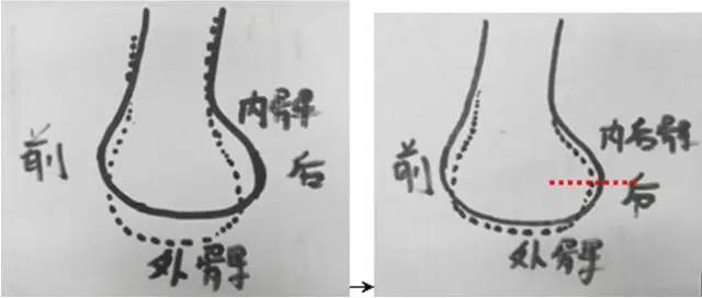 详细的膝关节X线解剖+解读+测量 详细的膝关节X线解剖+解读+测量