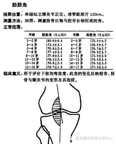 详细的膝关节X线解剖+解读+测量 详细的膝关节X线解剖+解读+测量
