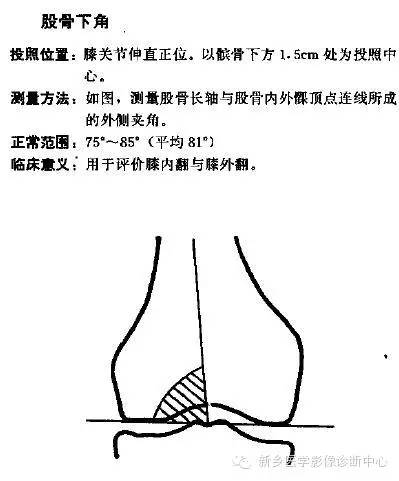 详细的膝关节X线解剖+解读+测量 详细的膝关节X线解剖+解读+测量