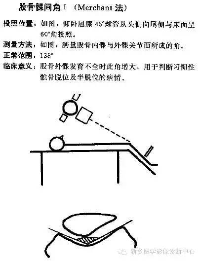 详细的膝关节X线解剖+解读+测量 详细的膝关节X线解剖+解读+测量
