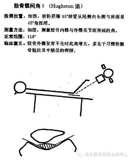 详细的膝关节X线解剖+解读+测量 详细的膝关节X线解剖+解读+测量