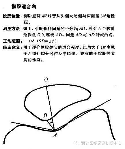 详细的膝关节X线解剖+解读+测量 详细的膝关节X线解剖+解读+测量