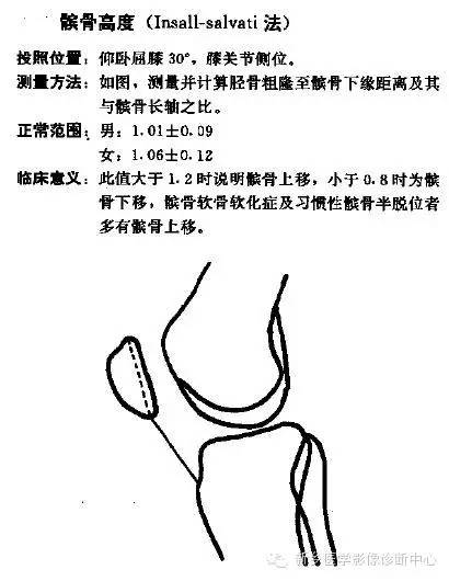 详细的膝关节X线解剖+解读+测量 详细的膝关节X线解剖+解读+测量