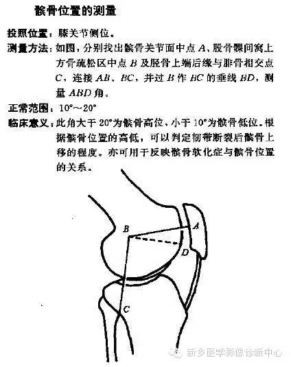 详细的膝关节X线解剖+解读+测量 详细的膝关节X线解剖+解读+测量