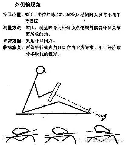 详细的膝关节X线解剖+解读+测量 详细的膝关节X线解剖+解读+测量