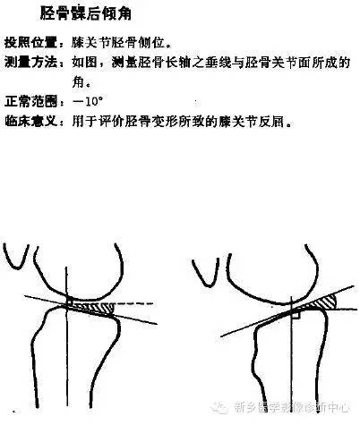 详细的膝关节X线解剖+解读+测量 详细的膝关节X线解剖+解读+测量