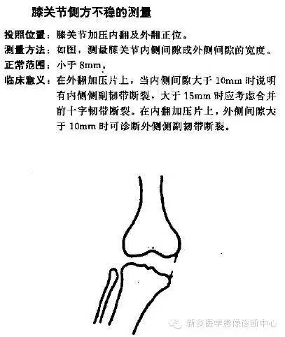 详细的膝关节X线解剖+解读+测量 详细的膝关节X线解剖+解读+测量