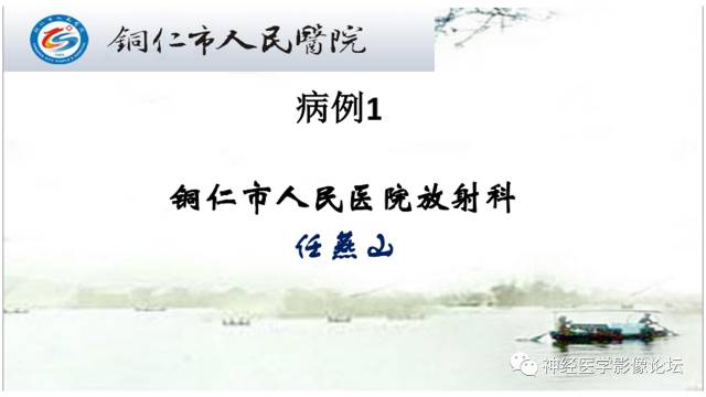【病例】颅骨骨膜窦1例MR影像表现