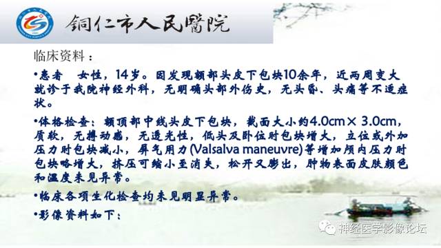 【病例】颅骨骨膜窦1例MR影像表现