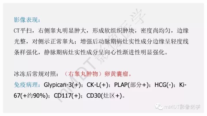 【PPT】卵黄囊瘤(内胚窦瘤)影像诊断