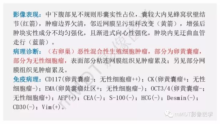 【PPT】卵黄囊瘤(内胚窦瘤)影像诊断