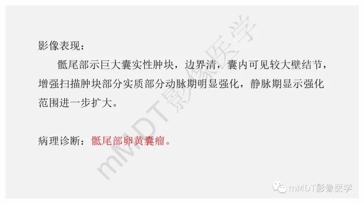 【PPT】卵黄囊瘤(内胚窦瘤)影像诊断