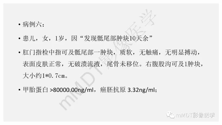 【PPT】卵黄囊瘤(内胚窦瘤)影像诊断