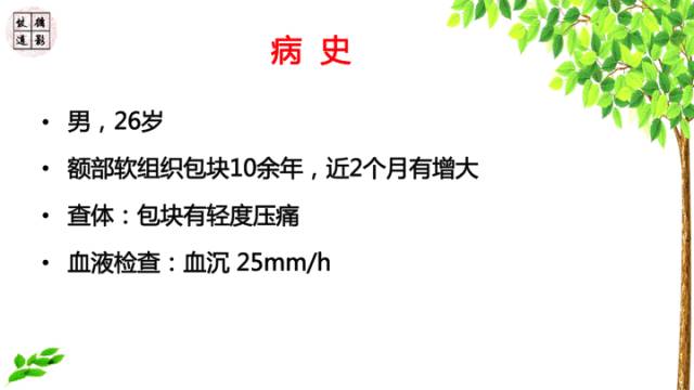 【病例】颅骨嗜酸性肉芽肿1例CT及MR影像诊断