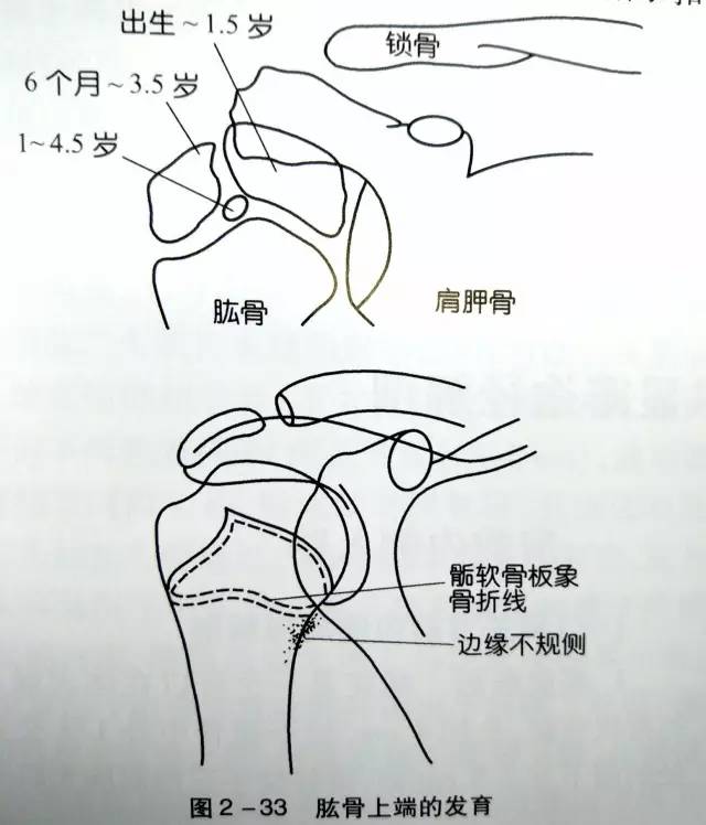 详细的肩关节X线解剖+发育+摄影技巧+测量方法 详细的肩关节X线解剖+发育+摄影技巧+测量方法