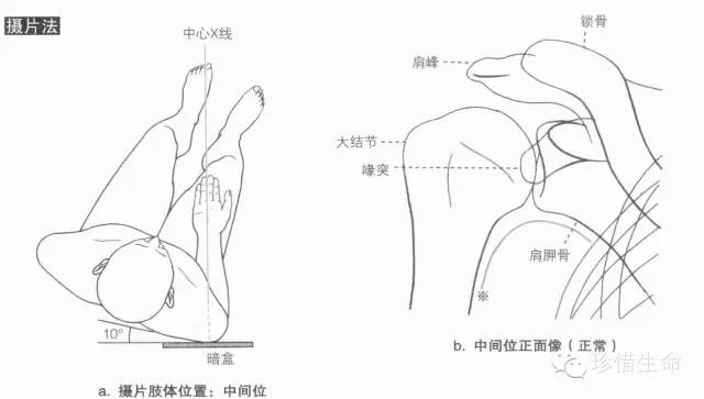 详细的肩关节X线解剖+发育+摄影技巧+测量方法 详细的肩关节X线解剖+发育+摄影技巧+测量方法