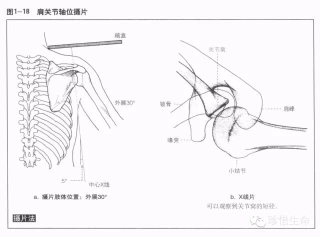 详细的肩关节X线解剖+发育+摄影技巧+测量方法 详细的肩关节X线解剖+发育+摄影技巧+测量方法