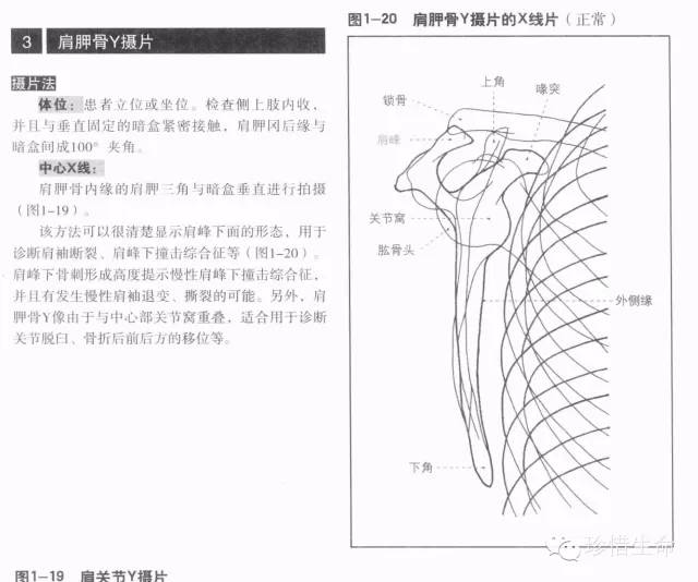 详细的肩关节X线解剖+发育+摄影技巧+测量方法 详细的肩关节X线解剖+发育+摄影技巧+测量方法