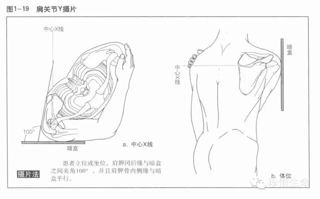 详细的肩关节X线解剖+发育+摄影技巧+测量方法 详细的肩关节X线解剖+发育+摄影技巧+测量方法