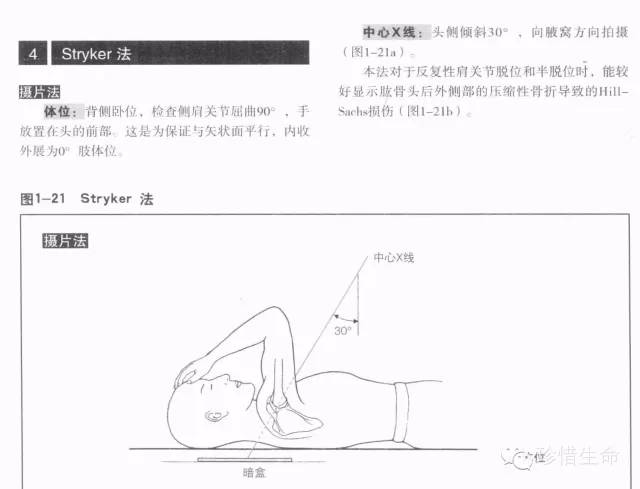 详细的肩关节X线解剖+发育+摄影技巧+测量方法 详细的肩关节X线解剖+发育+摄影技巧+测量方法