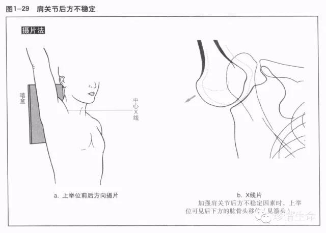 详细的肩关节X线解剖+发育+摄影技巧+测量方法 详细的肩关节X线解剖+发育+摄影技巧+测量方法