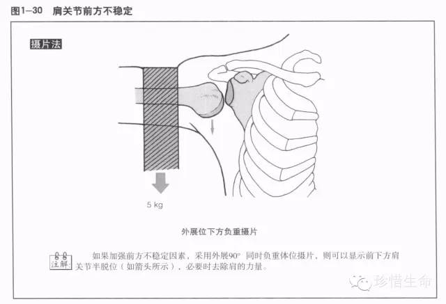 详细的肩关节X线解剖+发育+摄影技巧+测量方法 详细的肩关节X线解剖+发育+摄影技巧+测量方法