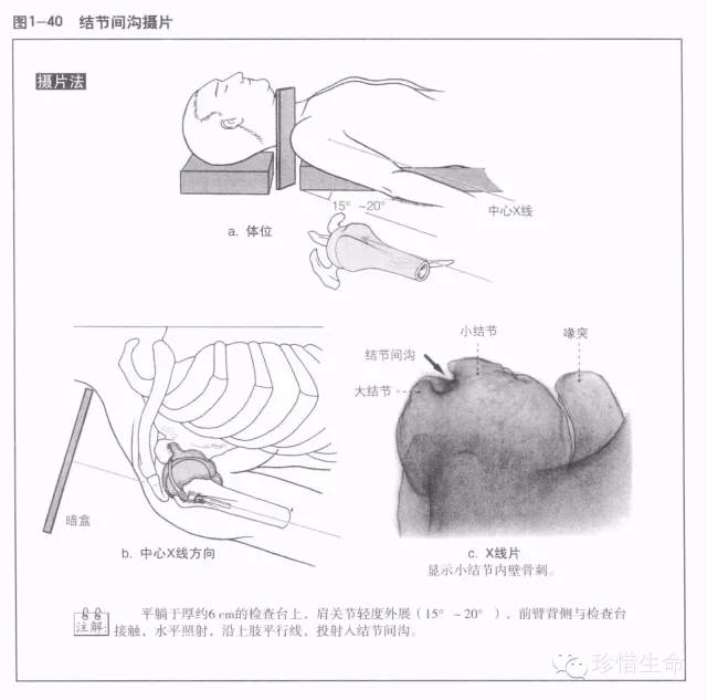 详细的肩关节X线解剖+发育+摄影技巧+测量方法 详细的肩关节X线解剖+发育+摄影技巧+测量方法
