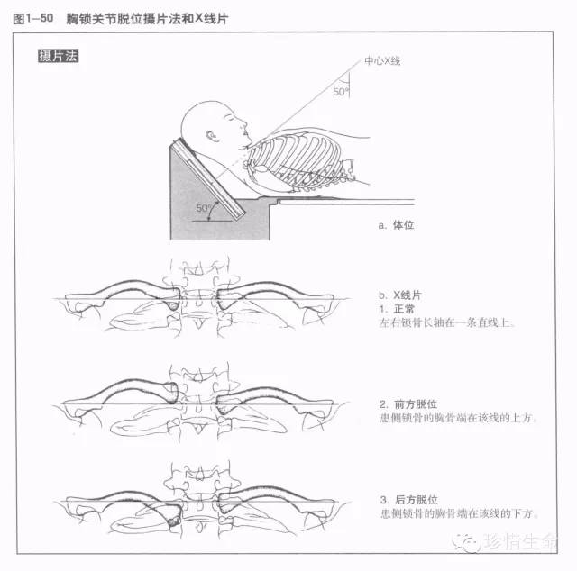详细的肩关节X线解剖+发育+摄影技巧+测量方法 详细的肩关节X线解剖+发育+摄影技巧+测量方法