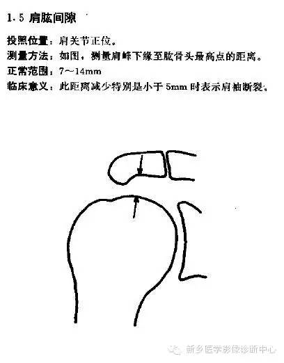 详细的肩关节X线解剖+发育+摄影技巧+测量方法 详细的肩关节X线解剖+发育+摄影技巧+测量方法
