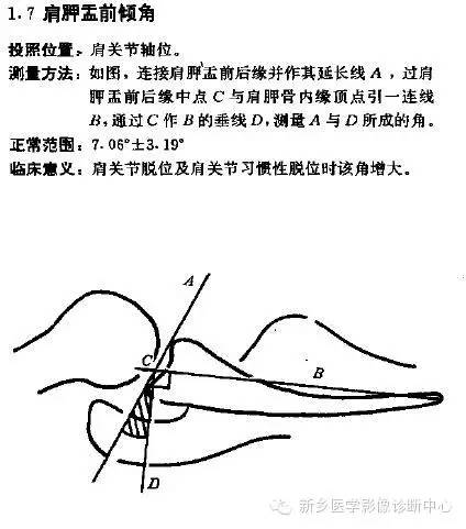 详细的肩关节X线解剖+发育+摄影技巧+测量方法 详细的肩关节X线解剖+发育+摄影技巧+测量方法