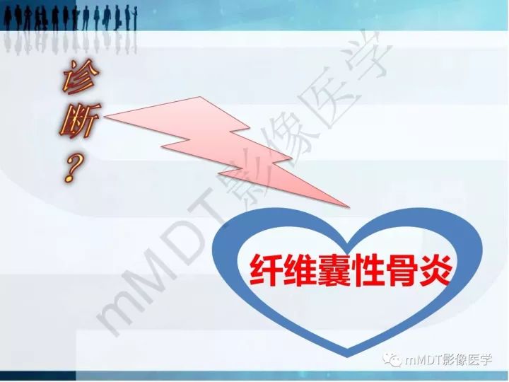 【PPT】纤维囊性骨炎的影像诊断