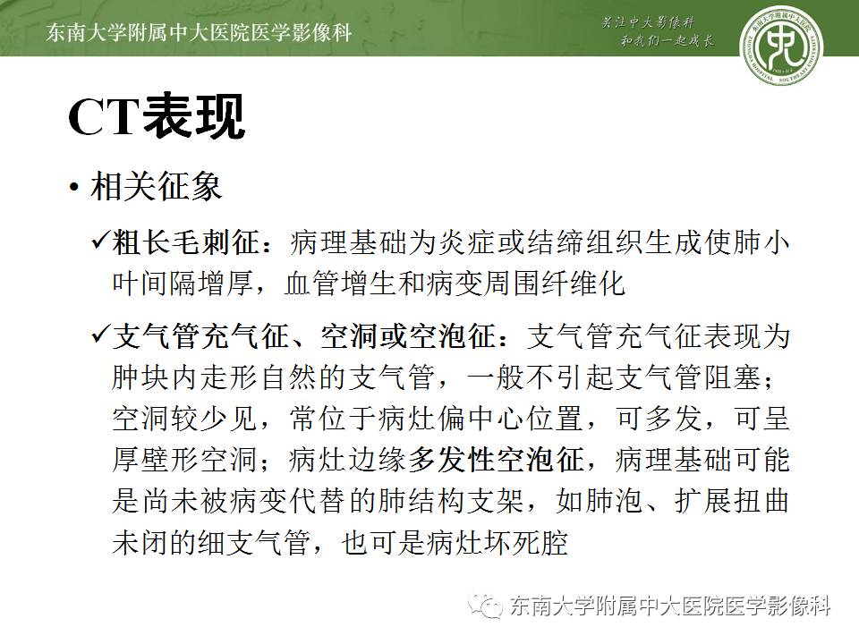 【病例】肺炎性假瘤1例CT影像表现