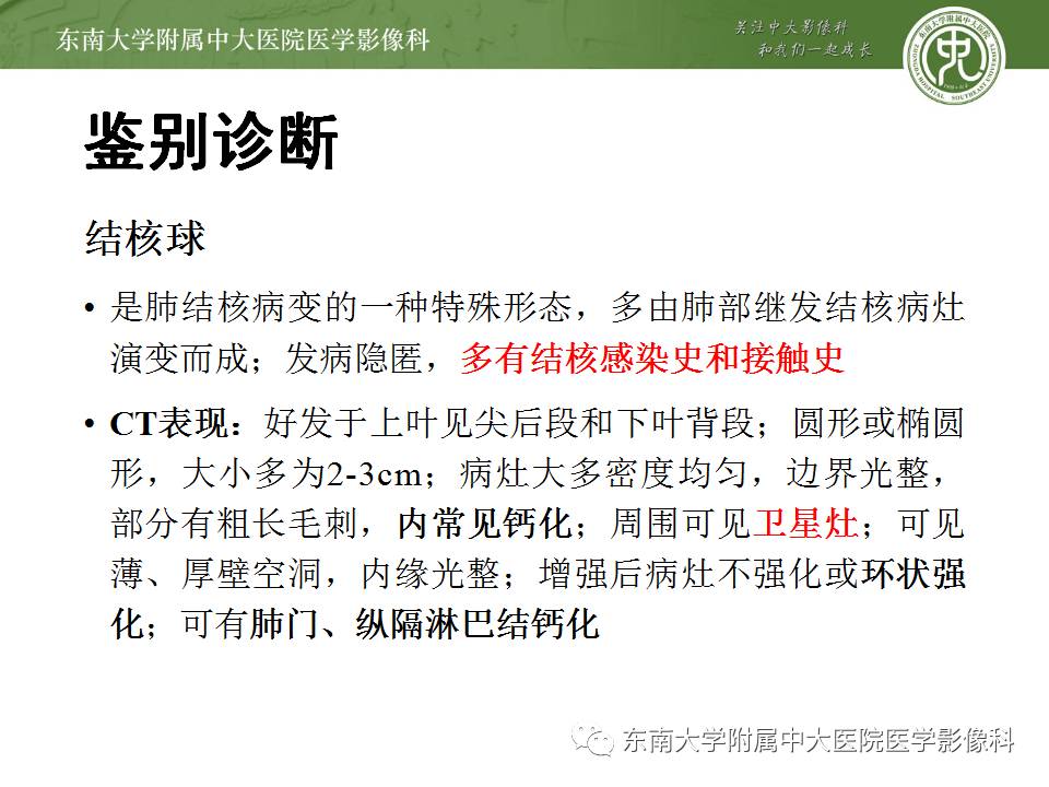 【病例】肺炎性假瘤1例CT影像表现
