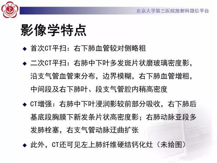 【病例】支气管动脉相关的咯血1例CT影像表现