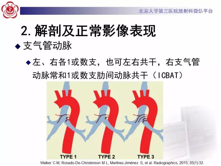【病例】支气管动脉相关的咯血1例CT影像表现
