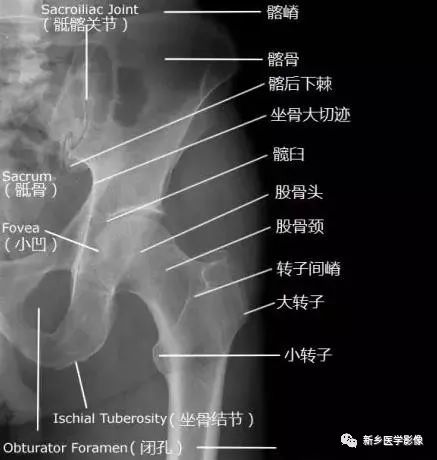 详细的髋关节X线解剖+摄影技术+测量方法