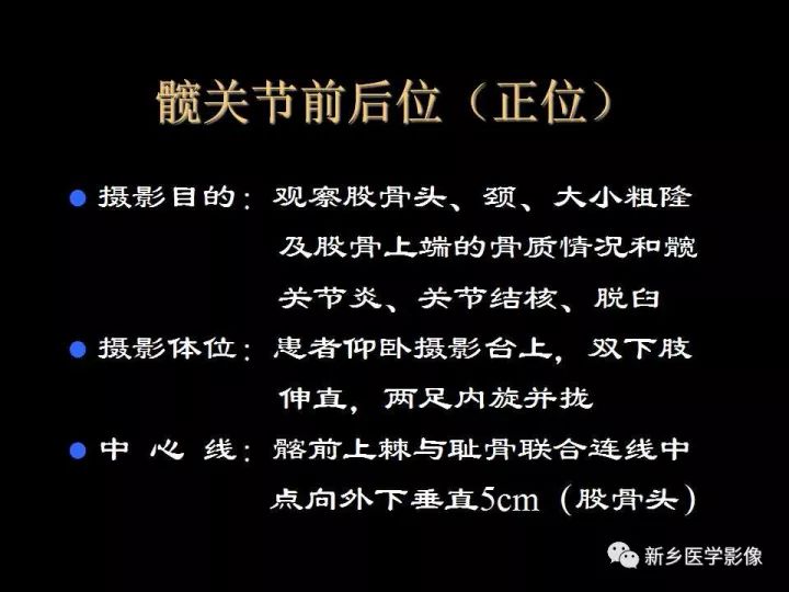 详细的髋关节X线解剖+摄影技术+测量方法 详细的髋关节X线解剖+摄影技术+测量方法
