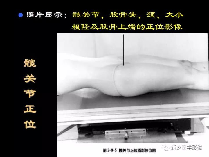 详细的髋关节X线解剖+摄影技术+测量方法 详细的髋关节X线解剖+摄影技术+测量方法