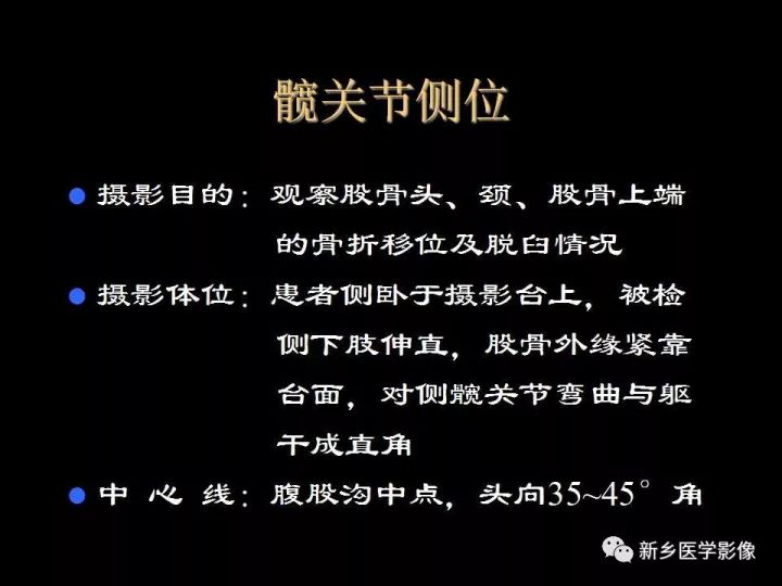 详细的髋关节X线解剖+摄影技术+测量方法 详细的髋关节X线解剖+摄影技术+测量方法