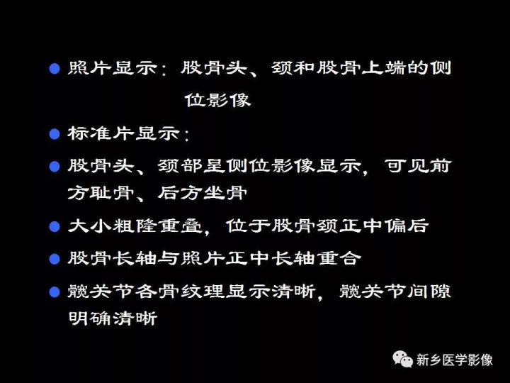 详细的髋关节X线解剖+摄影技术+测量方法 详细的髋关节X线解剖+摄影技术+测量方法